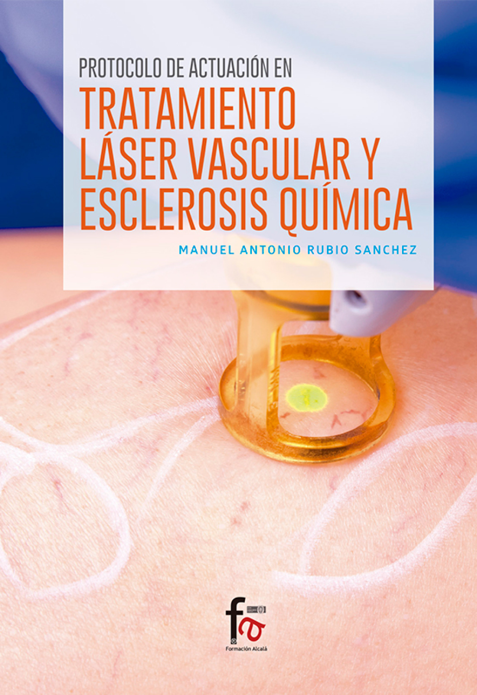 Protocol of action in Vascular Laser Treatment and Chemical Sclerosis