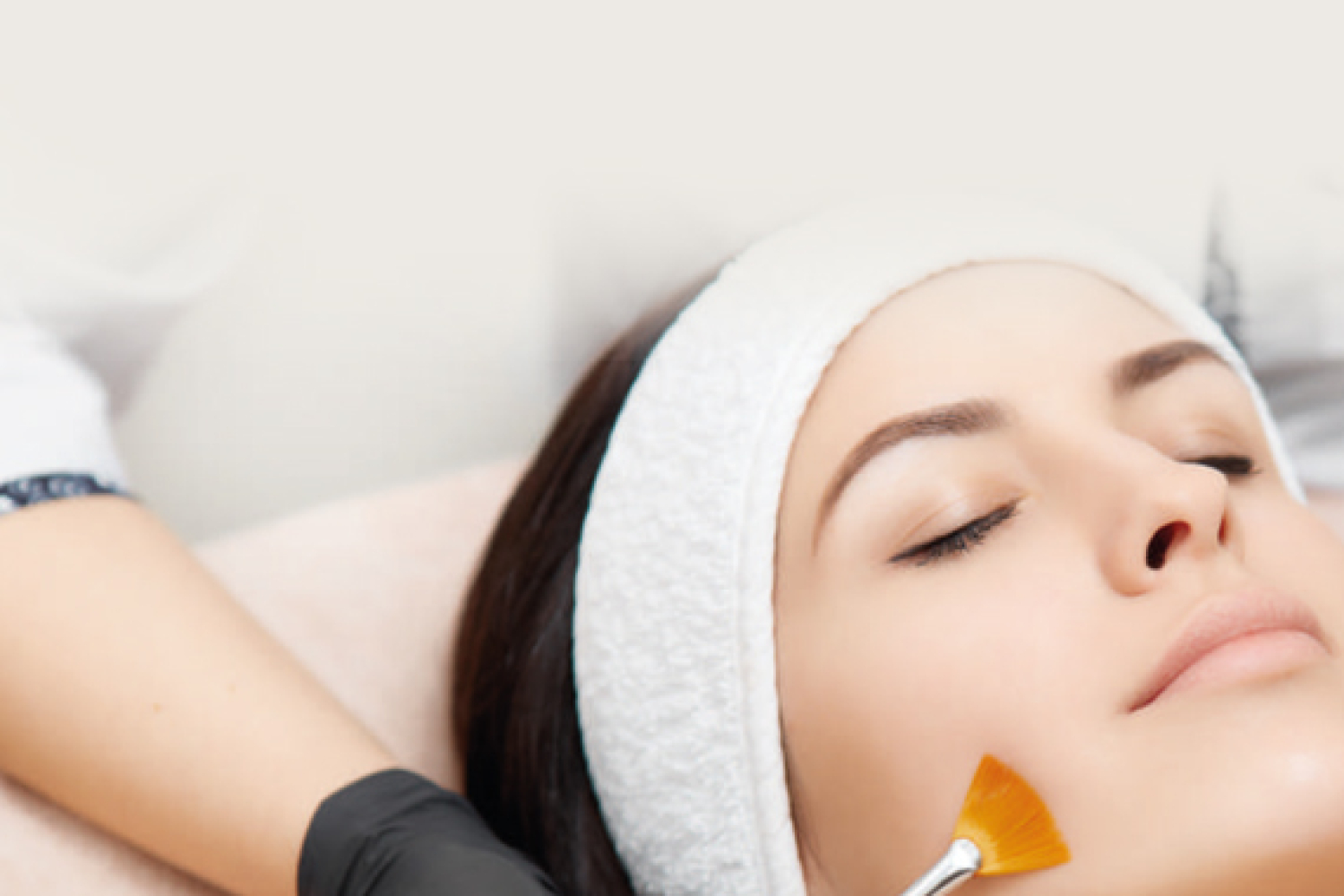 Protocolo de Peeling Médico Químico