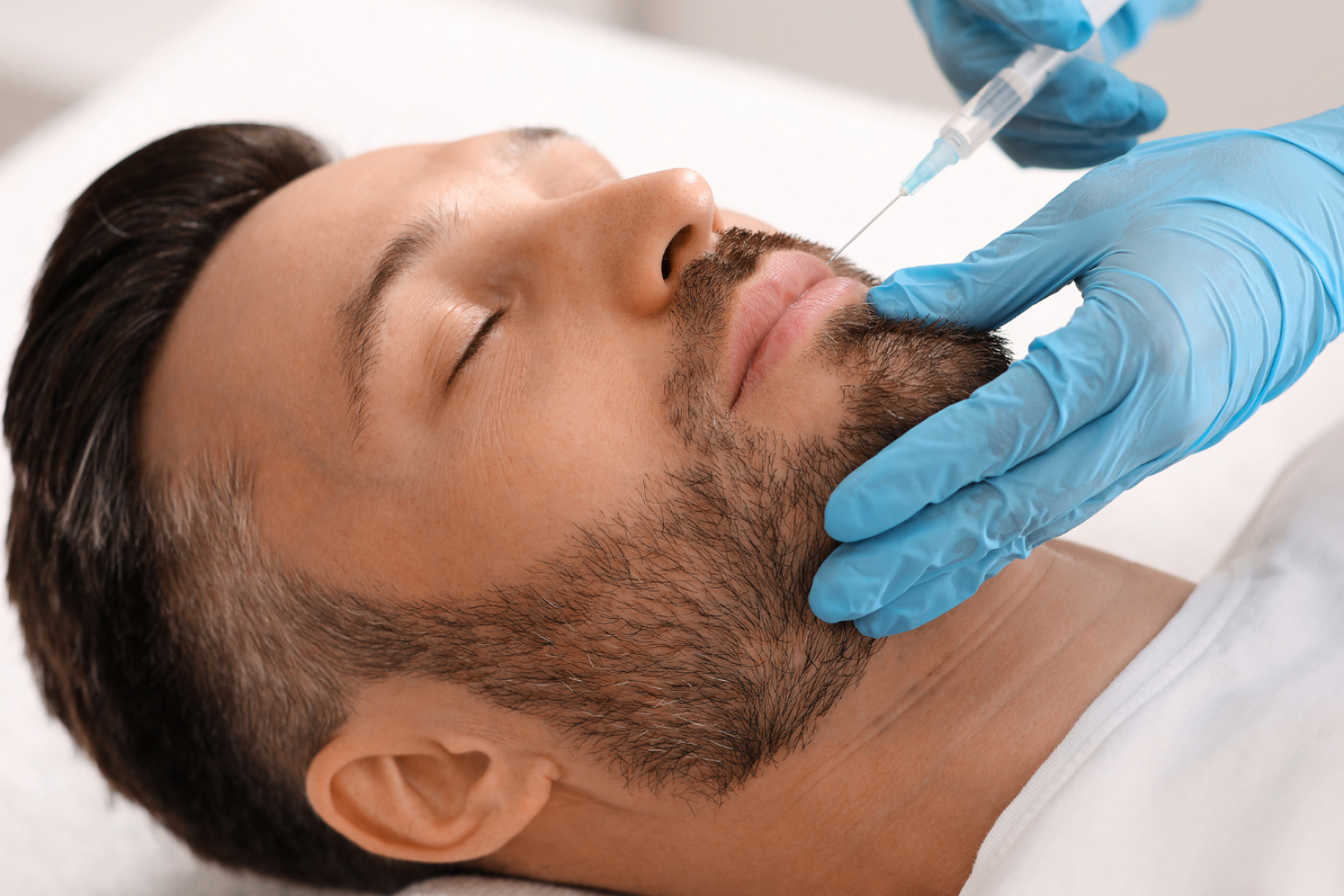 Masculinización Facial Avanzada: Estrategias Técnicas y Planes Full Face para Médicos Estéticos