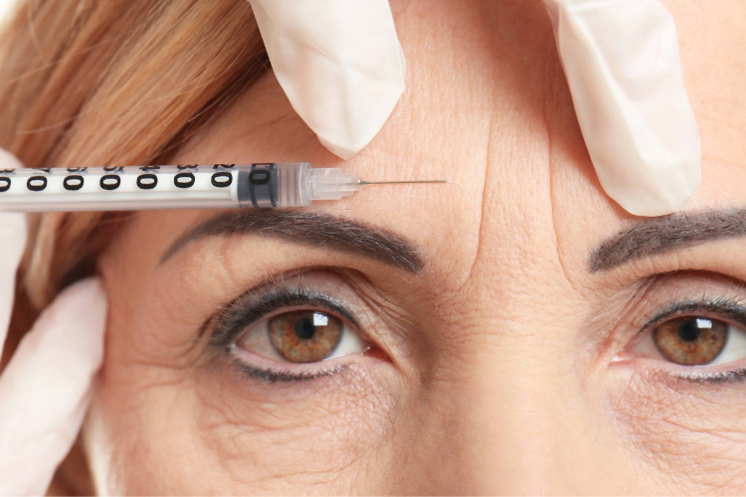 Botulinum Toxin Course (neuromodulators)