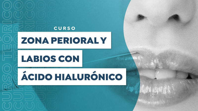 Perioral Area and Lips with Hyaluronic Acid