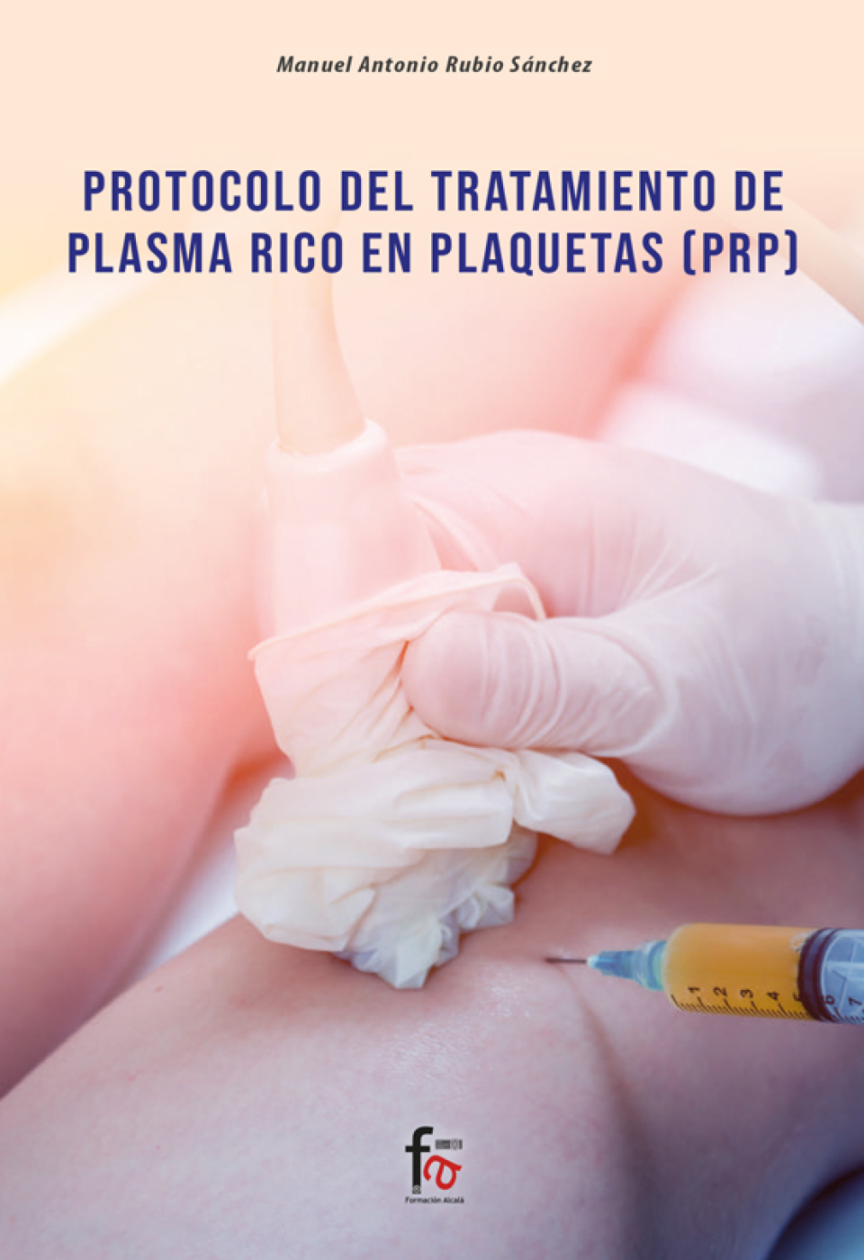 Protocolo del Tratamiento de Plasma Rico en Plaquetas - PRP