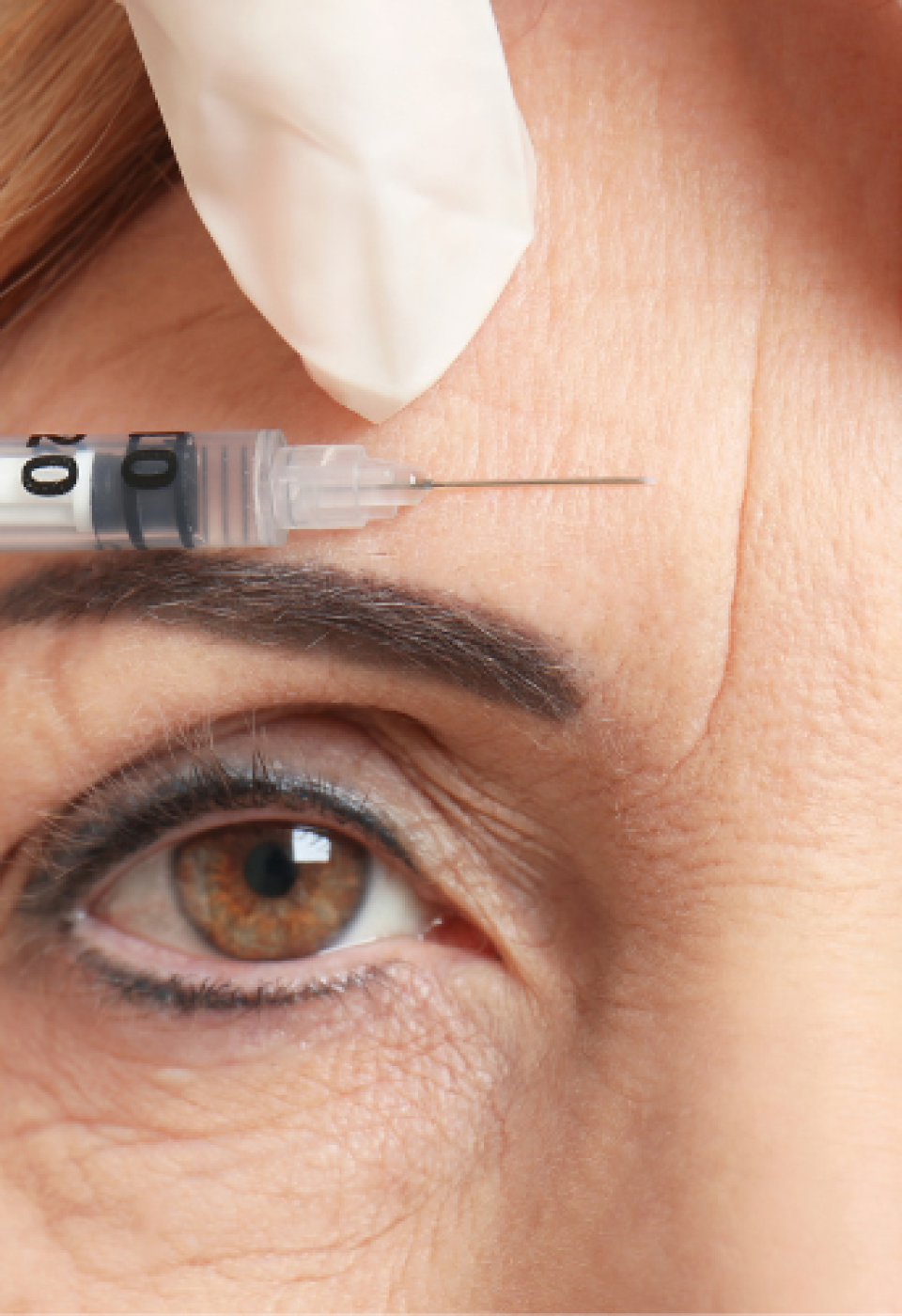 Botulinum Toxin Course (neuromodulators)