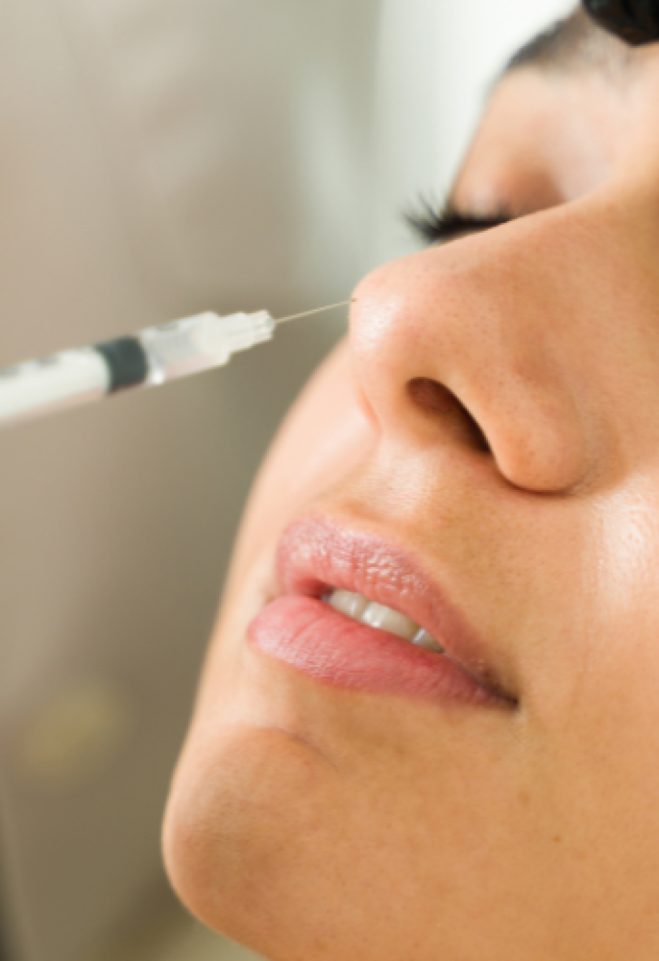 Rhinomodeling and Facial Fillers: The Step-by-Step Technique for Natural and Safe Results